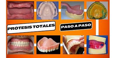 INSTITUTO SUPERIOR TECNICO LABORATORIO DENTAL(PASO DE LOS LIBRES)